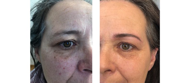 Raucherin Permanent-Make-up Haut Verbesserung