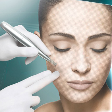 Micro Needling Starnberg