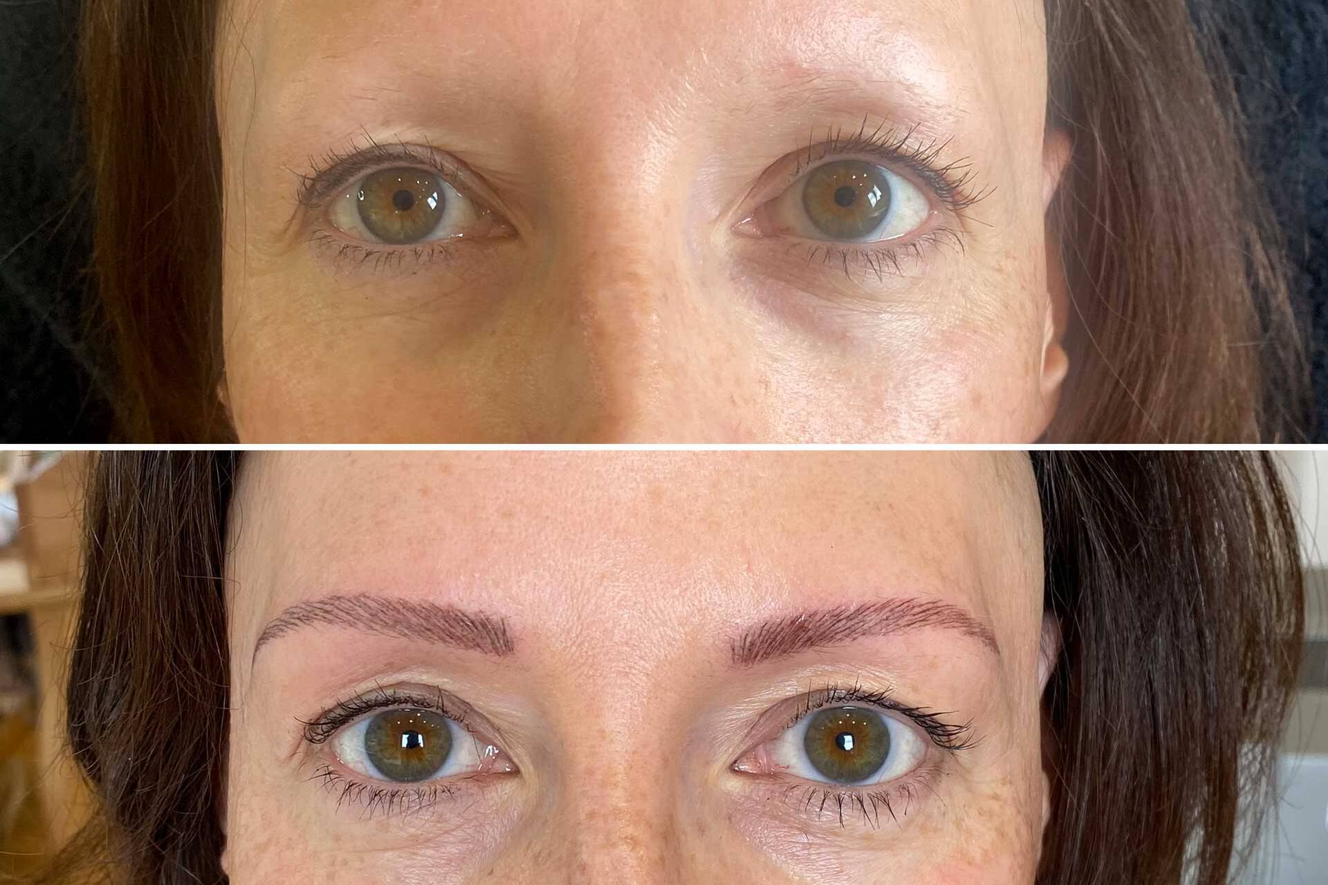 kreisrunder Haarausfall (Alopecia areata) | Medizinisches Permanent Make-up Starnberg