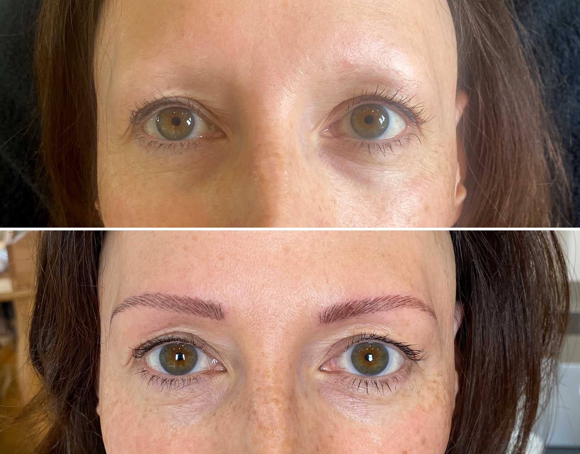 kreisrunder Haarausfall (Alopecia areata) | Medizinisches Permanent Make-up Starnberg