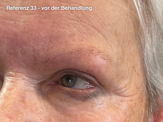 PMU-Augenbrauen_Plochmann33v